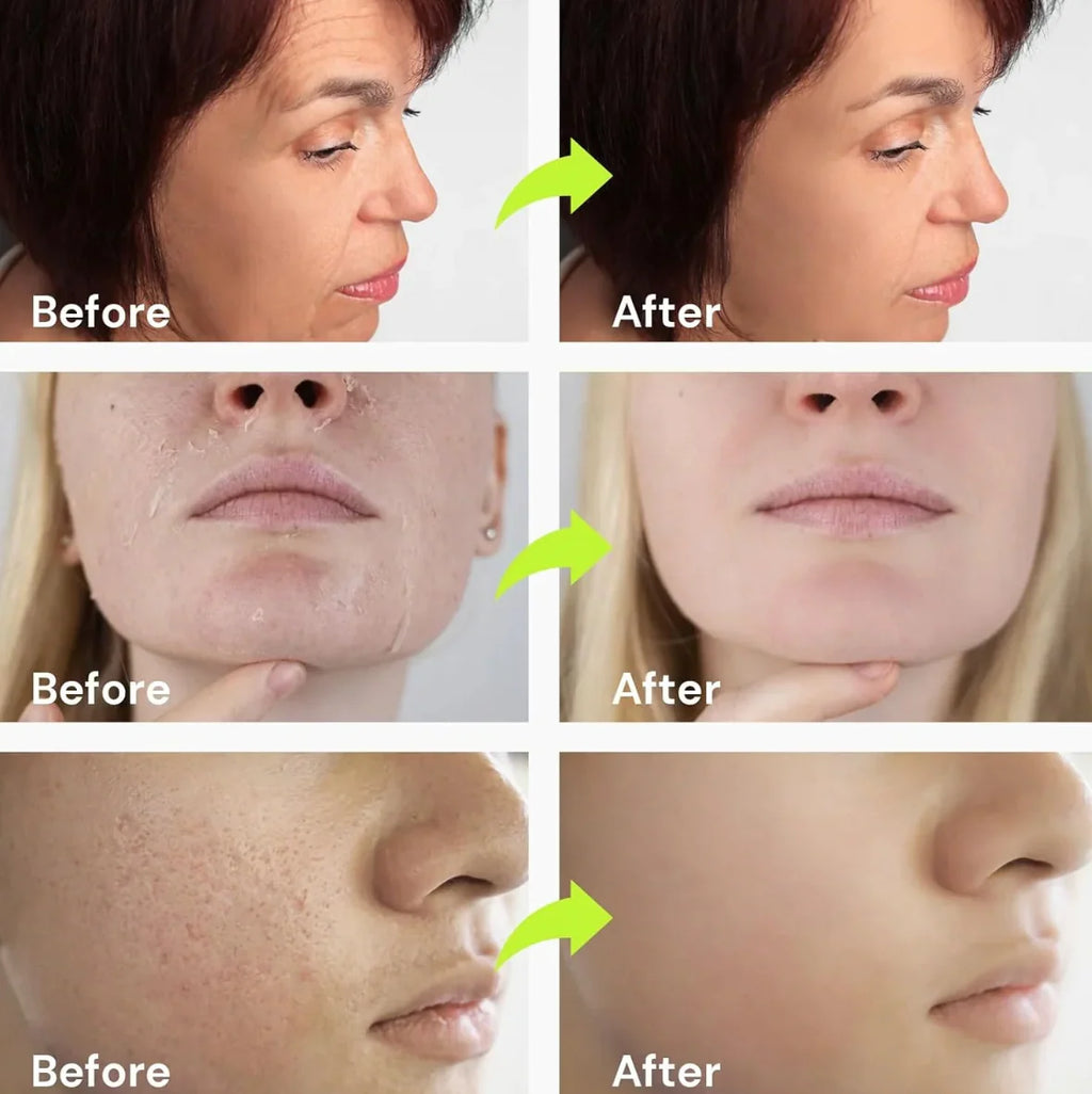 Siegen Botox Retinal Firming Cream