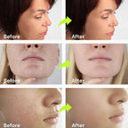 Siegen Botox Retinal Firming Cream